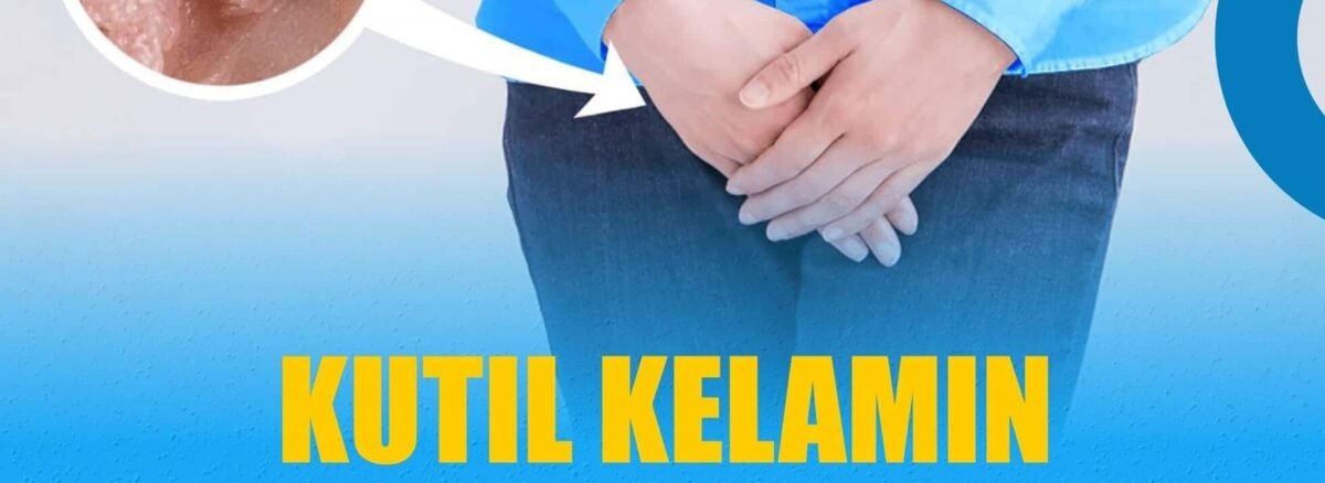 Kutil Kelamin Klinik Penyakit Menular Seksual